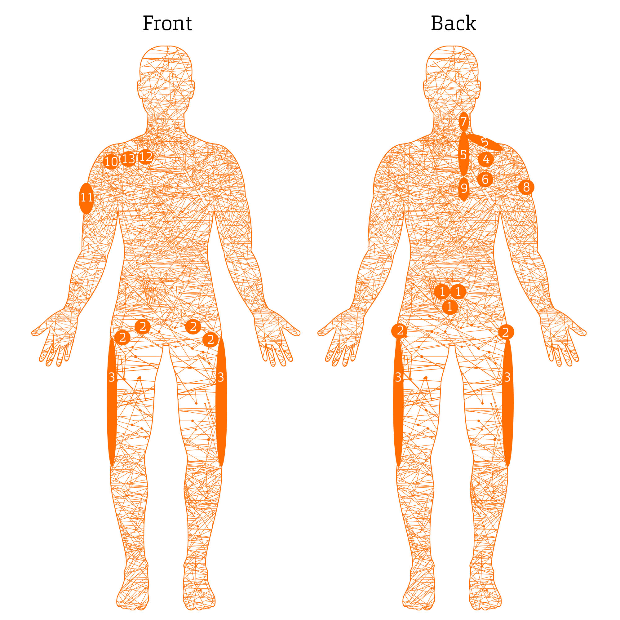 FROZEN SHOULDER! - New Therapeutic Techniques 